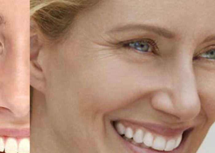 header-menopausa_1920